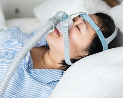 Girl sleeping with the help of sleep apnea device customized by dentist in Mississauga.