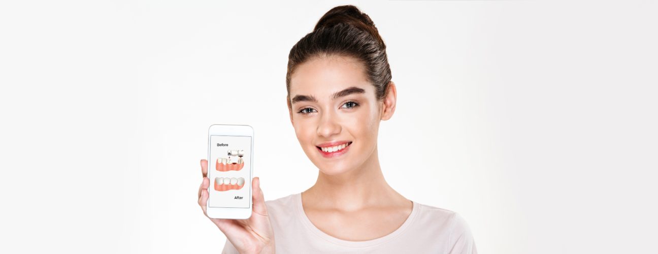 Restoring Missing Teeth with Dental Bridges by Mississauga Dentist